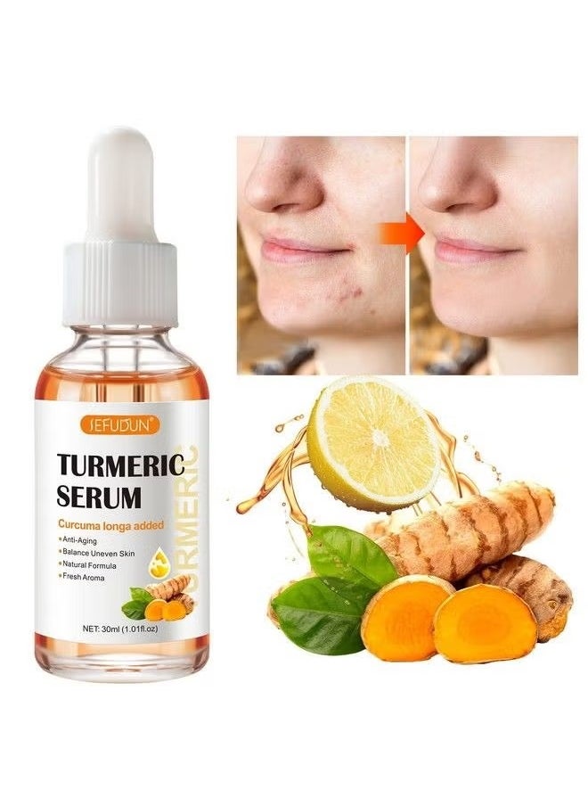 Sefudun - Turmeric Serum for Dark Spots 1 Fl Oz, Turmeric Dark Spot Corrector Serum for Face & Body, Anti Aging Facial Serum for Women and Men, Reduces Hyperpigmentation, Age Spots, Sun Spot, Improve Skin Tone - Image 1
