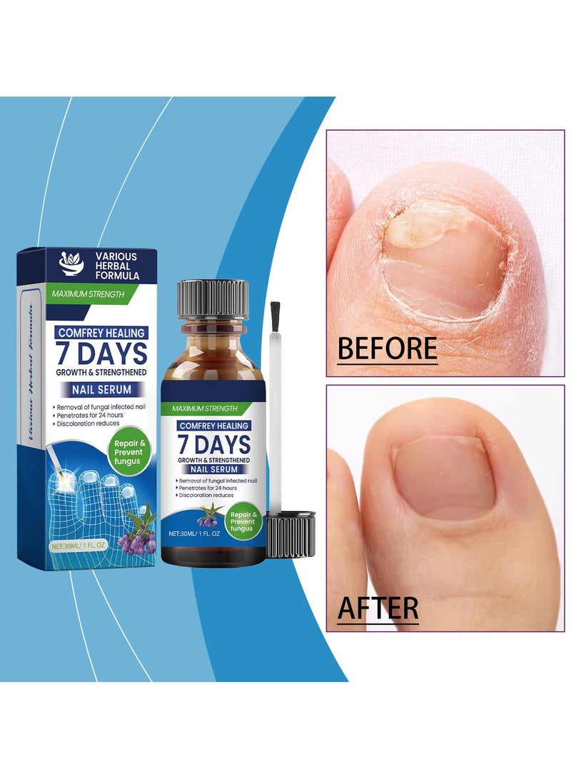 7 Days Nail Repairserum Nail Cleansing, Gentle Repairof Cuticles, Nail Care And Repairliquid（30ml） - Image 3