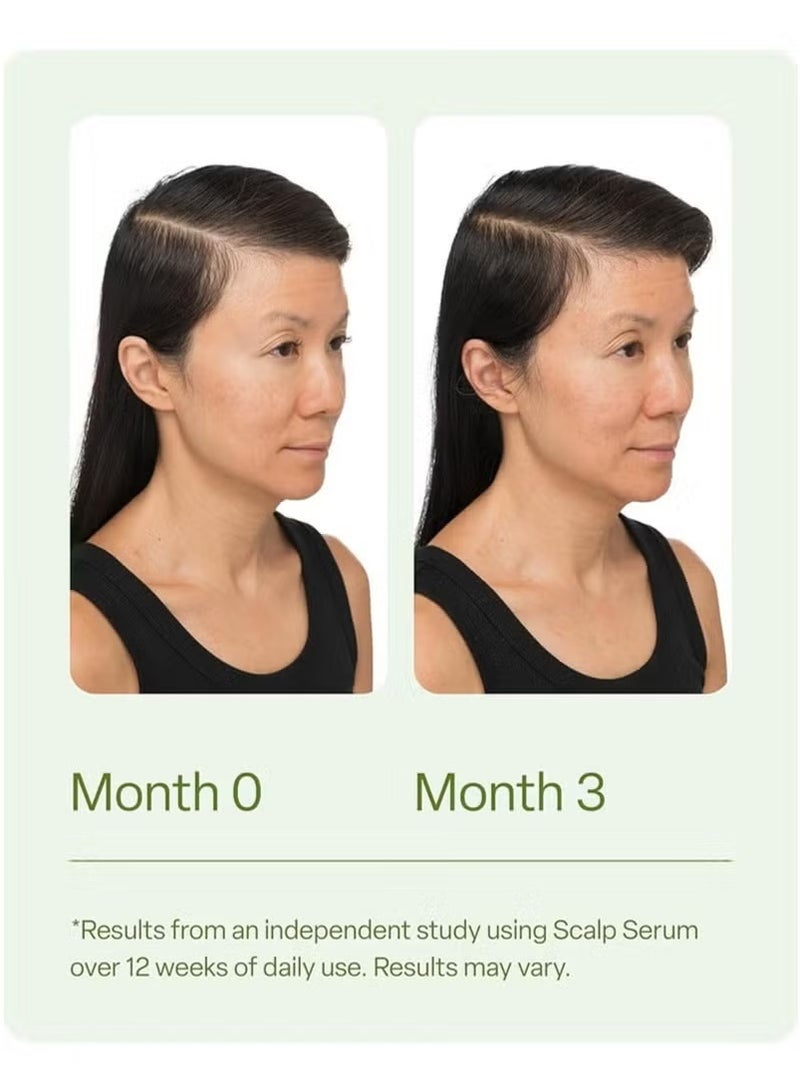 Divi Scalp Serum for Thinning Hair, 30ml,Clinically Tested,Nourishing Formula with Amino Acids,Caffeine and Rosemary Oil,Promotes Healthy Scalp and Fuller-Looking Hair, Reduces Oil and Product Buildup*2Pcs - Image 3