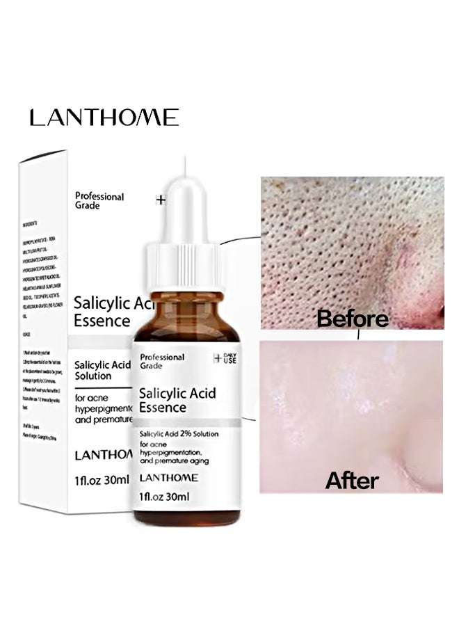 Lanthome Salicylic Acid Essence-Salicylic Acid 2% Solution for Acne Hyperpigmentation and Premature Aging，Blackhead and Open Pores, Reduces Excess Oil and Bumpy Texture, Acne Prone and Oily Skin for Women and Men 30ml - Image 1