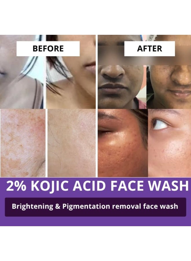 BAKE 2% Kojic Acid Brightening Face Wash Dual Action Formula with Alpha Arbutin & Niacinamide | De-Tan Wash | For Pigmentation, Dark Spots & Tan Removal | Anti Pigmentation Daily Wash - 100ml (1, Kojic Acid Face Wash) - Image 4