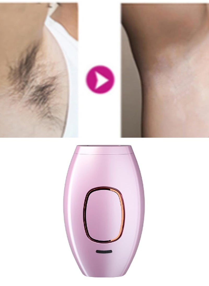 Arabest Hair Removal System for Women,epilator Laser Depilator Painless Mini 999000 Flashes Facial Whole Body at Home Hair Remover Device for Women (Pink)  - Image 1