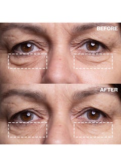 WRINKLES SCHMINKLES Wrinkles Schminkles Under Eye Patches - Rejuvenate Wrinkles with Medical Grade Silicone Reusable Anti-Wrinkle Patches for Under Eye Treatment, Banish Dark Circles (3 Pairs)  - Image 3