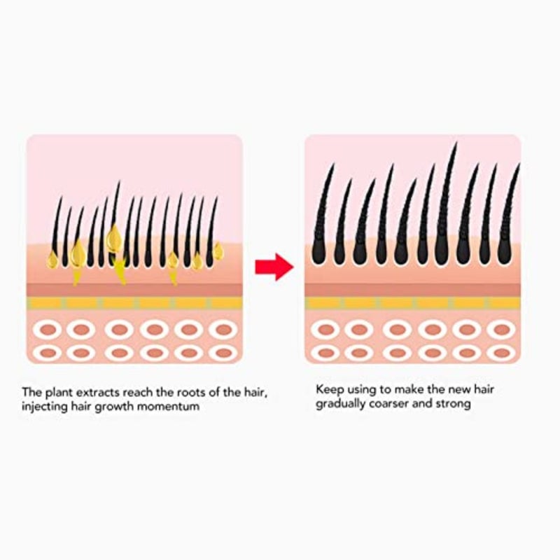 Hair Oil Applicator Scalp Massager, Scalp Oil Applicator 15ml Transparent Serum Dispenser with Comb Massage Function Scalp Care Solution for Home and Salon Purple - Image 5