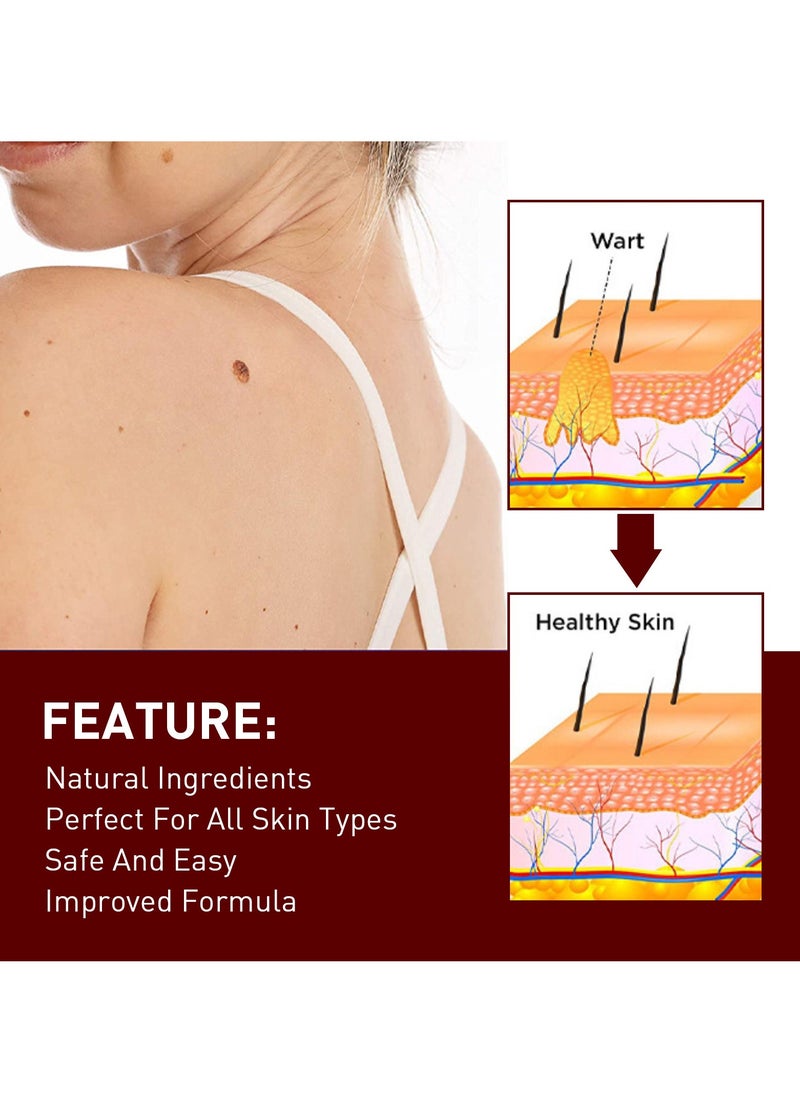 Jaysuing Supwell Wart Removing Pen, Common Mole Skin Tag Remover, Fast Effective Painless Blemish Removal Wart Remover Liquid Pen Gel for Skin Warts Tag Mole (3ml)  - Image 4