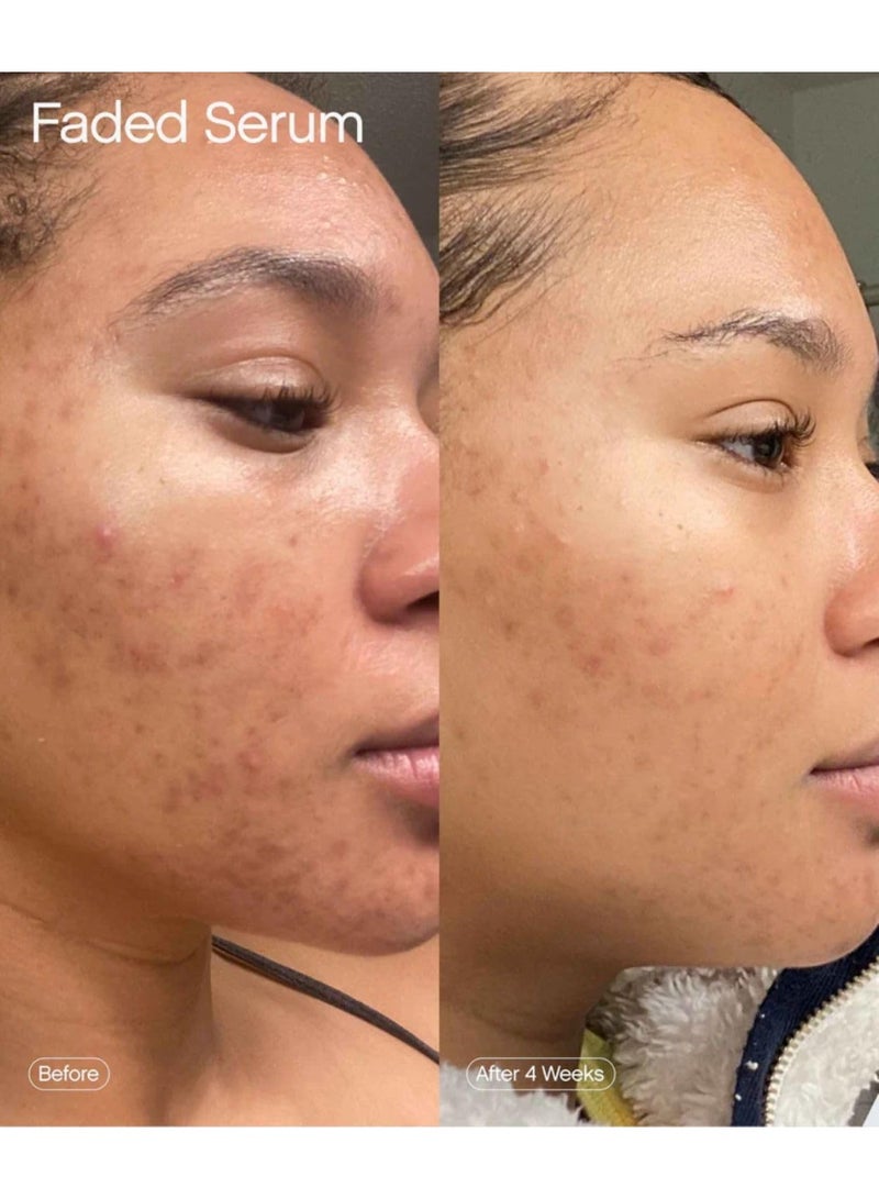 TOPICALS Faded Brightening & Clearing Serum 50ml | Dark Spot Correcting Treatment for Hyperpigmentation, Acne Marks & Uneven Skin Tone - Image 5