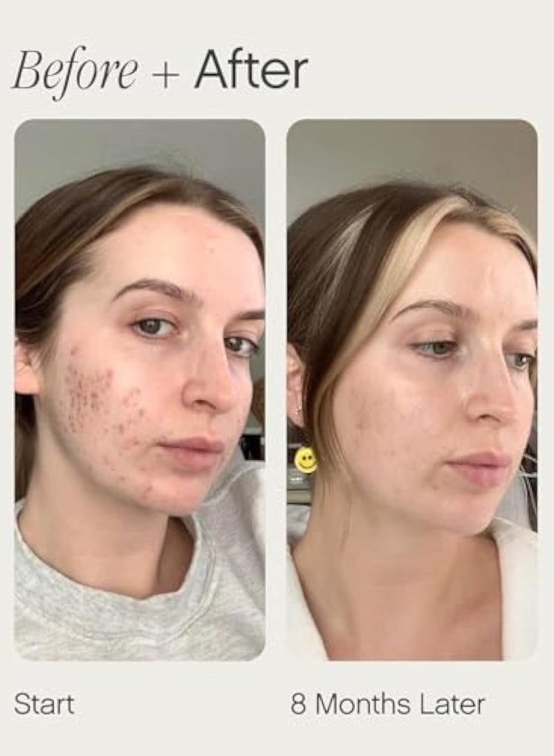 Topicals Mini Faded Serum for Dark Spots & Discoloration, Neutral, 15 ml (Pack of 1), 0.5 fl oz - Image 4