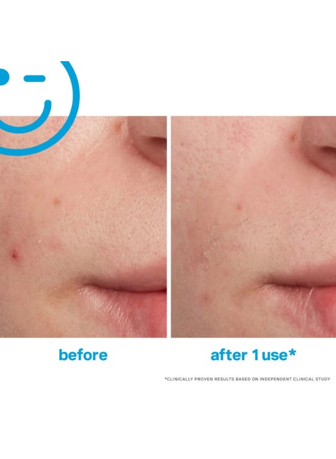 Kate Somerville EradiKate Blemish Treatment 30ml - Image 2