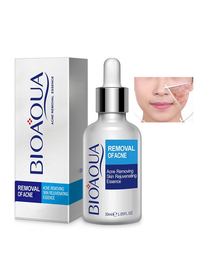 BIOAOUA Acne Removing Skin Rejuvenating Essence, Nourishing Facial Serum for Water-Oil Balance Control and Acne Root Elimination, Gentle Skin Care, 30ml - Image 1