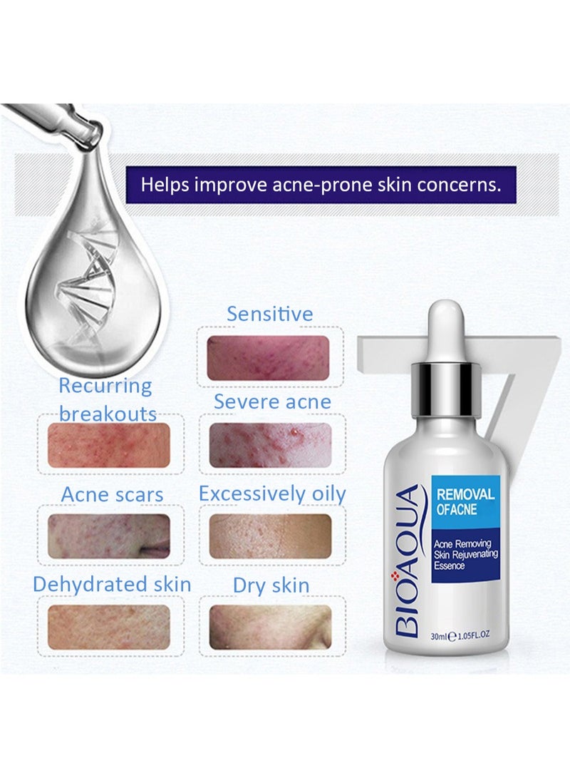 BIOAOUA Acne Removing Skin Rejuvenating Essence, Nourishing Facial Serum for Water-Oil Balance Control and Acne Root Elimination, Gentle Skin Care, 30ml - Image 2