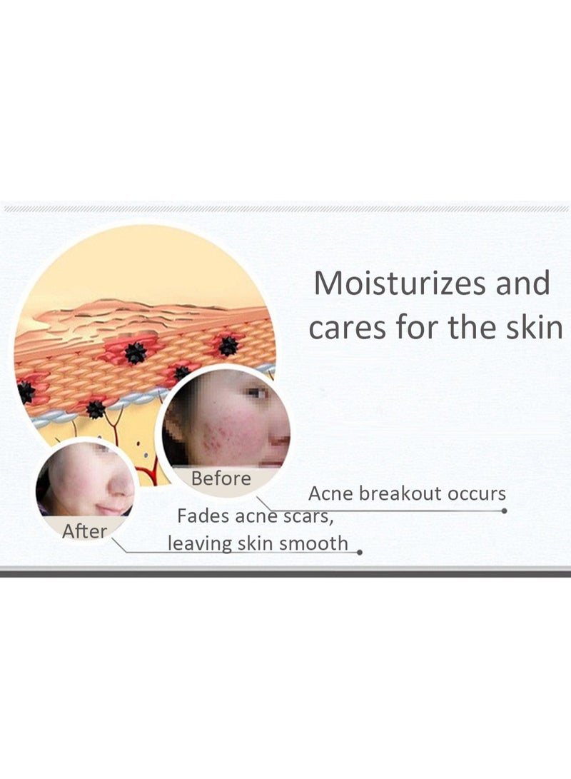 BIOAOUA Acne Removing Skin Rejuvenating Essence, Nourishing Facial Serum for Water-Oil Balance Control and Acne Root Elimination, Gentle Skin Care, 30ml - Image 3