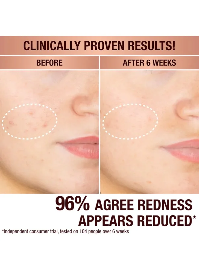 Charlotte Tilbury Dark Spot Correcting Radiance Recovery Serum
