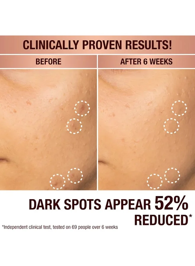 Charlotte Tilbury Dark Spot Correcting Radiance Recovery Serum