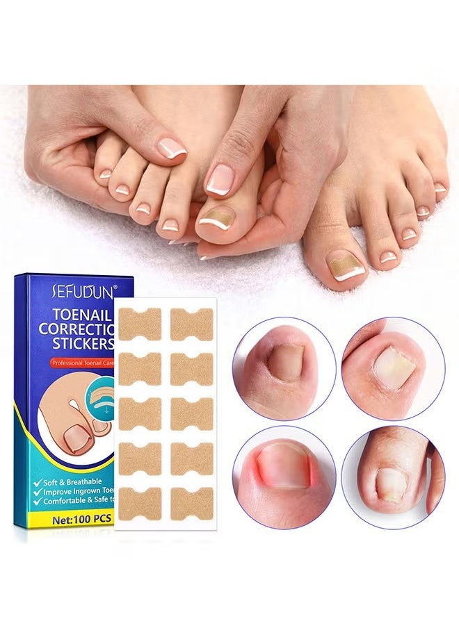 Sefudun - Ingrown Toenail Corrector Patch, 100PCS Ingrown Toenail Corrector Strips, Toenail Correction Patches, Ingrown Toenail Treatment Tool Foot Care, No-Glue Toenail Correction Stickers - Image 1