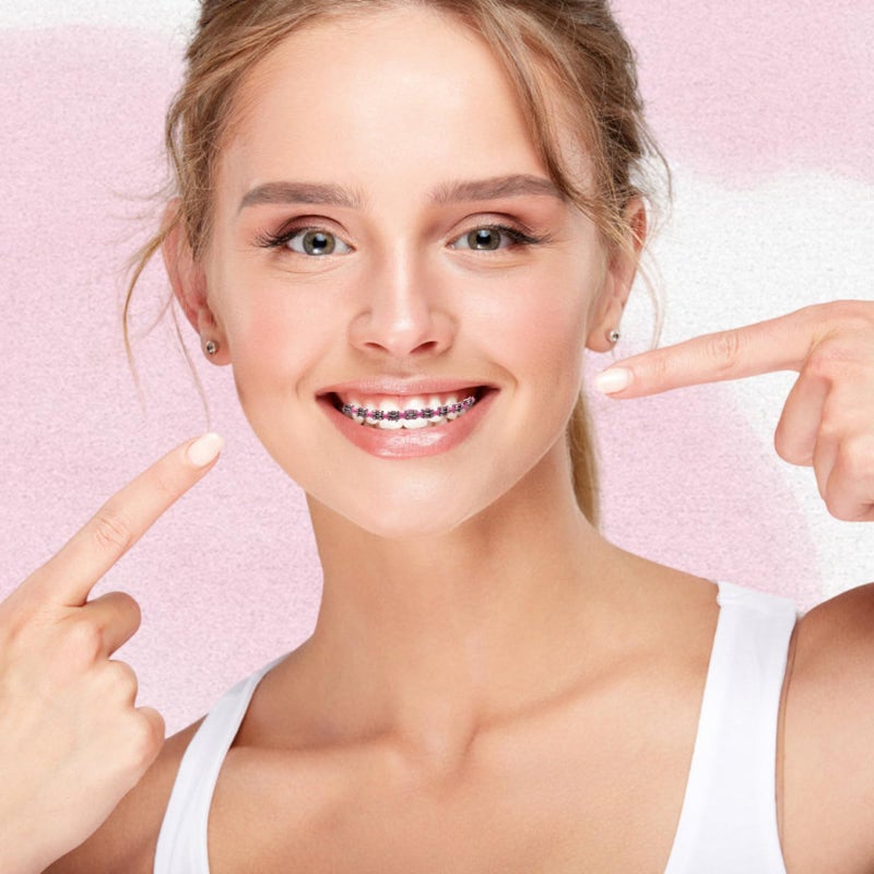 panthra Fake Braces 2-Pcs Set Temporary Tooth Decoration with Metal Wires, Metal Brackets and Orthodontic Bands, Suitable for Orthodontists to Explain, for Dental Students to Practice (Pink) - Image 4