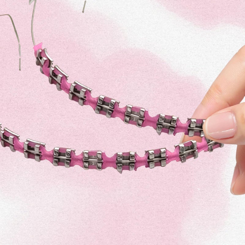 panthra Fake Braces 2-Pcs Set Temporary Tooth Decoration with Metal Wires, Metal Brackets and Orthodontic Bands, Suitable for Orthodontists to Explain, for Dental Students to Practice (Pink) - Image 5