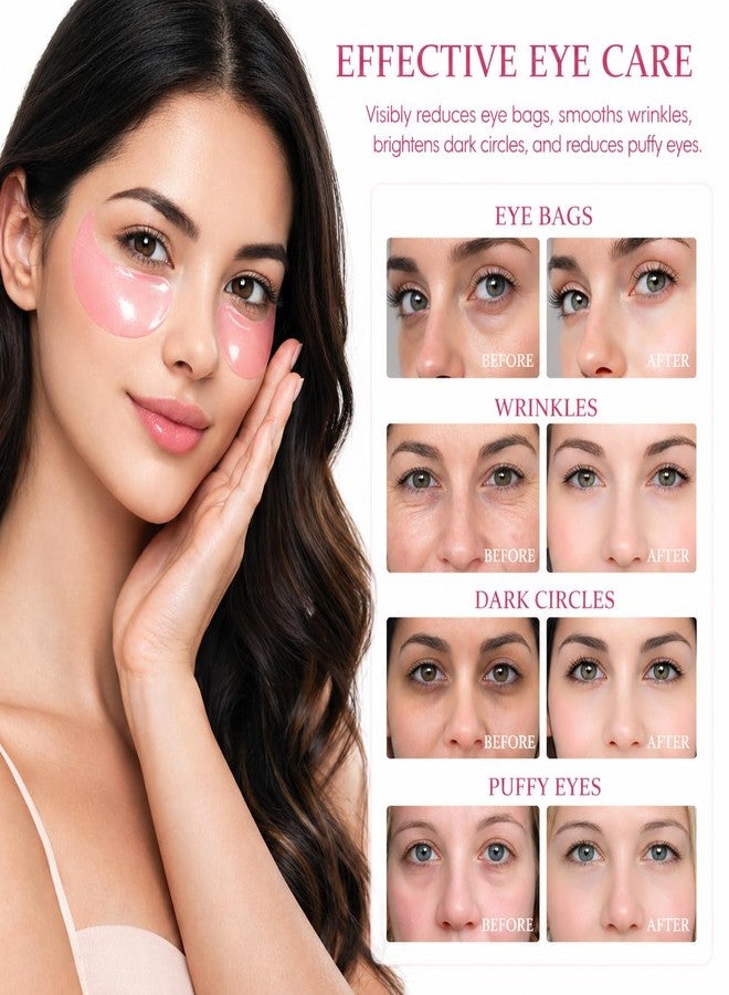 Mererke_Pretty Under Eye Patches– 60 Pcs, Rose Under Eye Masks for Dark Circles, Puffy Eyes, Bags & Wrinkles with Collagen, Revitalize and Moisturize, Cooling and Hydrating, Suitable For Men and Women - Image 5
