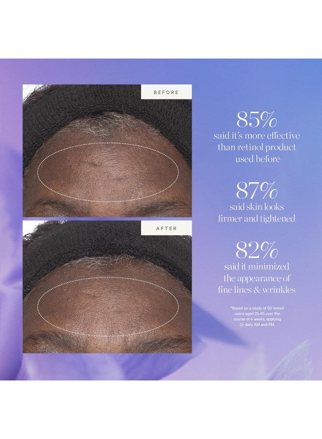 كورا أوجانيكس مرطب بديل الريتينول من الخلايا الجذعية النباتية، مزيج بديل الريتينول النشط ينعم التجاعيد ويشد البشرة، 1.69 أونصة سائلة - Image 4