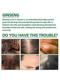 OUHOE Natural Herbs Ginseng Essence Moisturizing Hair Mist, Rapid Growth Hair Treatment 7 Day Hair Growth Serum Essence Oil Regrow, for Women & Men 100ML  - Image 3