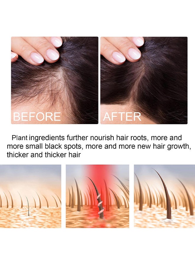SOUTH MOON - Green Ginger Hair Regrowth Spray, Hair Nourishing Growth Spray, Moisturizing Fast Growth Anti-Defixation Spray Growth Solution, Organic Growth Plus Nourishing Ginger Spray For Men And Women, 100ML - Image 1