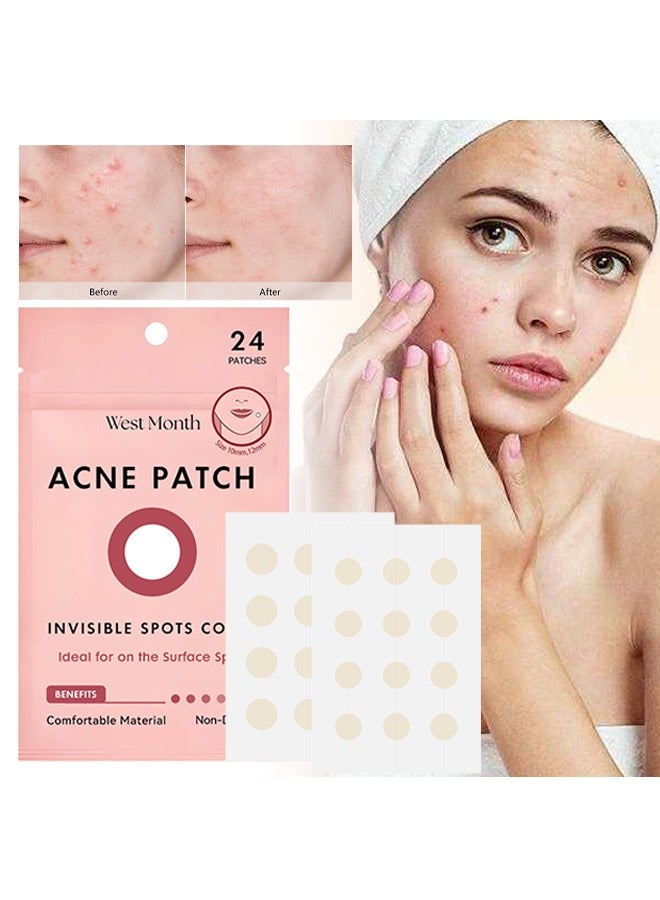 Acne Patch ,Salicylic Acid Hydrocolloid Acne Patch Miracle Patch, Invisible Spots Cover, Ideal for On The Surface Spots ,24 Patches