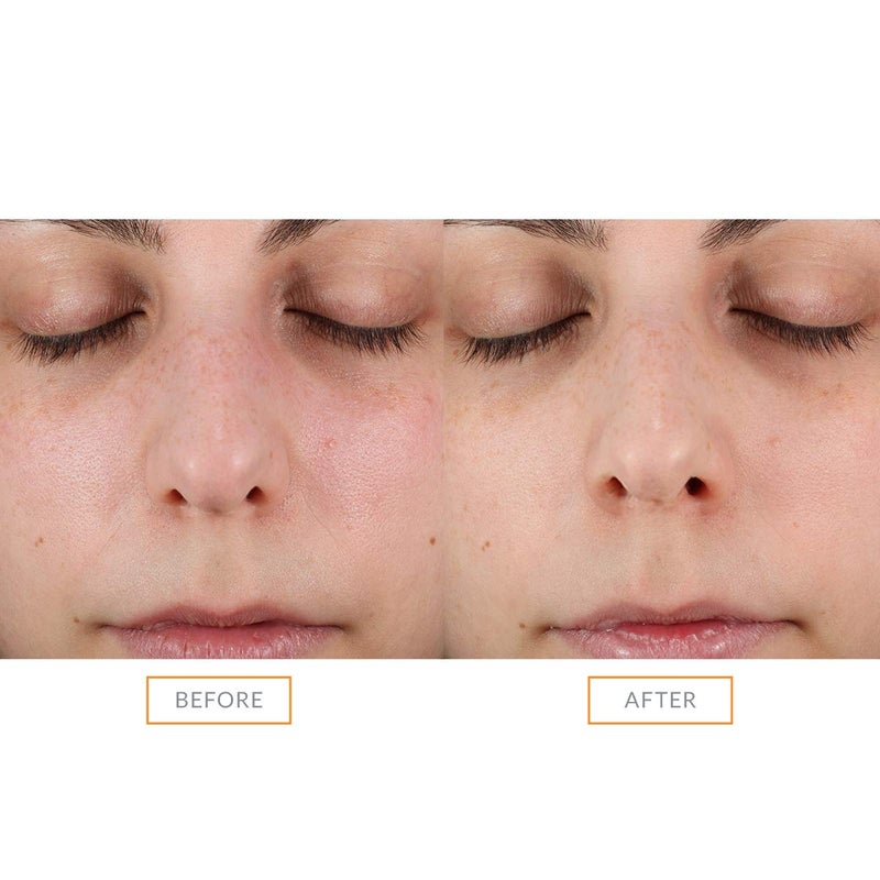 Clarisonic رأس فرشاة التنظيف المقشر الصوتي من كلاريسونيك | فرشاة تقشير لطيفة لتفتيح البشرة | مناسبة للبشرة الحساسة - Image 4