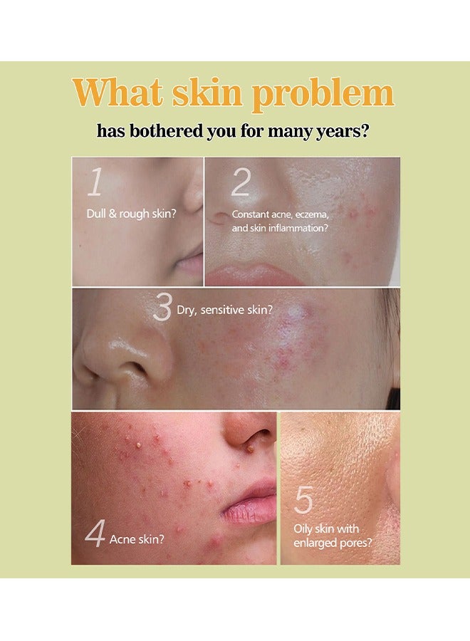 EELHOE African Black Soap - Black Shampoo Bar for Dry Skin Pimples and Blackhead Hydrate Nourish and Clean Impurities with Coconut Olive Oil and Shea Butter Face and Body Wash Multi Use Soap 100 - Image 3