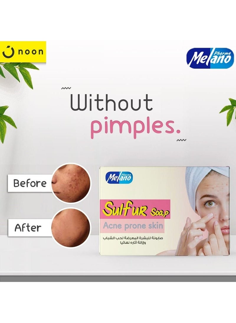 MELANO - Melano Sulfur Soap For Acne Prone Skin - Image 1