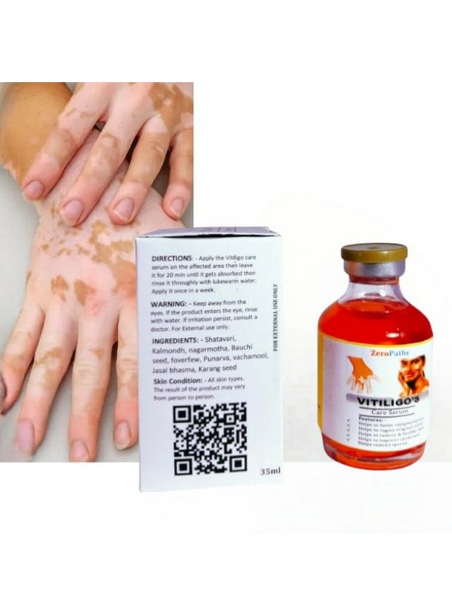 Zero Pathy مرهم البقع البيضاء، لعلامات البياض، فيتيليغو طبيعي مع الكركم، الألوة فيرا والجينسنغ، مصمم لاستعادة تصبغ الجلد، سيروم إزالة علامات الترطيب لعلاج الأمراض - Image 4