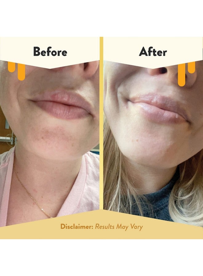 ECZEMA HONEY Nourishing Lip Balm - Organic Chapstick for Sensitive Skin - Daily Lip Moisturizer for Very Dry Lips - Mango Butter & Honey Lip Balm - Natural Lip Care Products (1 Ct) - Image 4