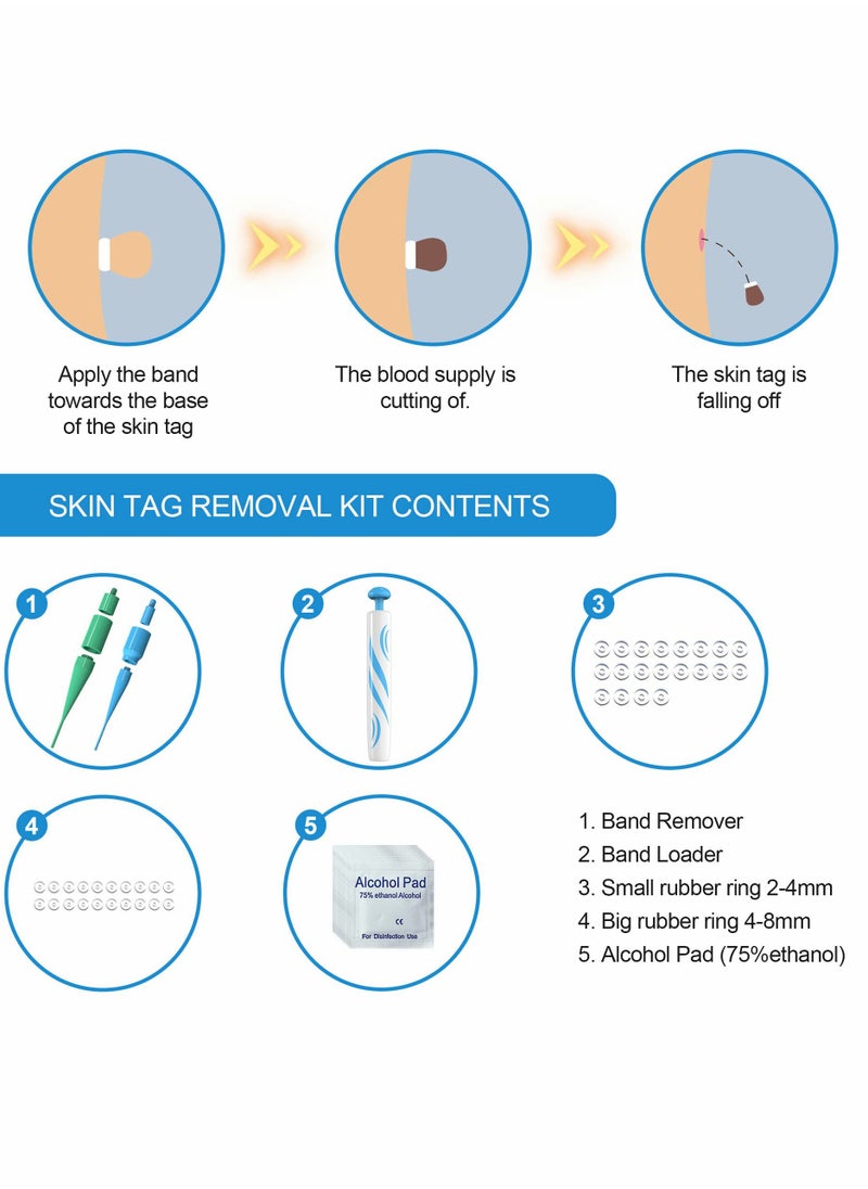 Generic - Skin Tag Remover,Painless Remover Pen,Skin Removal Kit Tools with 40 Micro and Regular Bands,Easy Device to Remove (2mm-8mm) - Image 1