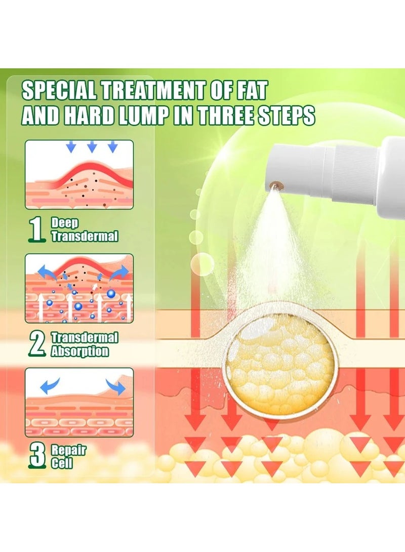سوميفون بخاخ سوميفن العشبي لإزالة الأورام الشحمية 30 مل، علاج فعال لإزالة التكوينات تحت الجلد. - Image 4