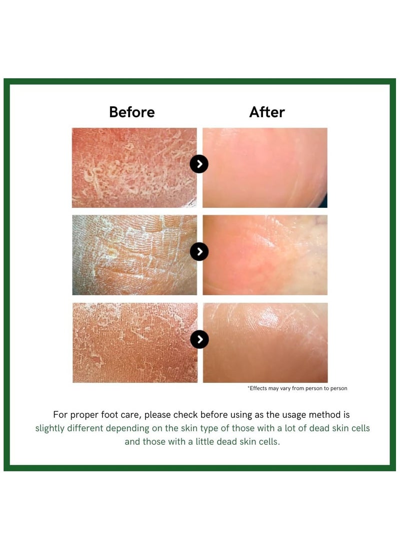 3WB | Premium Foot Cream for Dry Cracked Heels Feet Knees Elbows Hands, Foot Dead Skin Cuticle Callus Remover Toenail Softener, Keratolytic Skin Barrier Repair Cream, 100g, Made in Korea