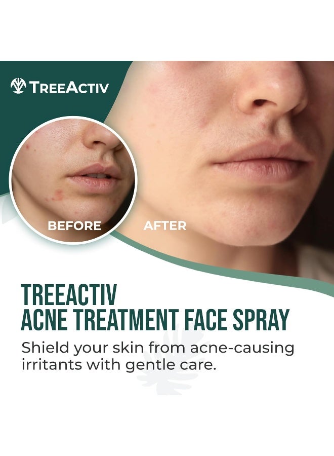 TreeActiv Acne Treatment Face Spray, 4 fl oz - Image 2