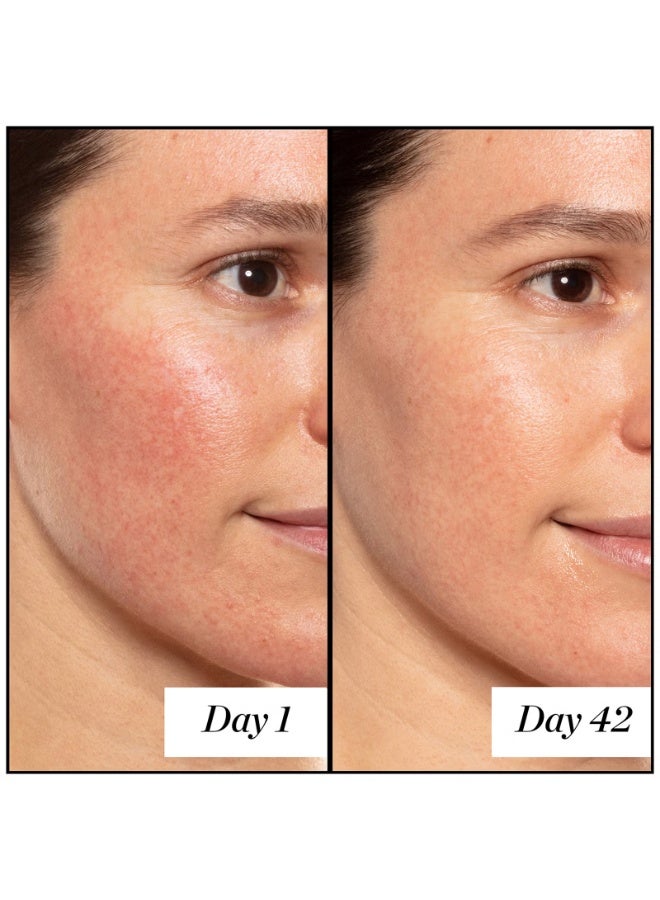 Sunday Riley A+ High-Dose Retinoid Serum 30ml - Image 4