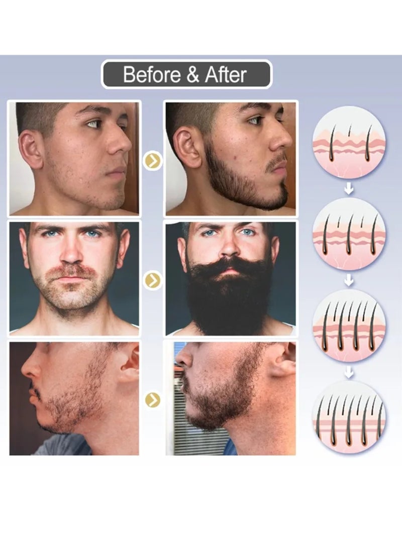 East Moon Beard Growth Fluid for Faster Mustache Growth Beard Growth Serum Beard Growth Oil Beard Growth Promoting Serum Beard and Hair Growth Oil Beard Enhancer Beard Growth Spray Beard Loss regrowth Treatment Beard Oil 30ml  - Image 4
