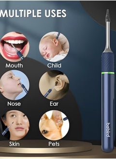 Bebird Bebird Note 5 Ear Wax Removal Kit Wi-Fi Visible Wax Elimination Spoon 10 Megapixels HD with 4 LED Lights for Ear Cleaning, Blue  - Image 2