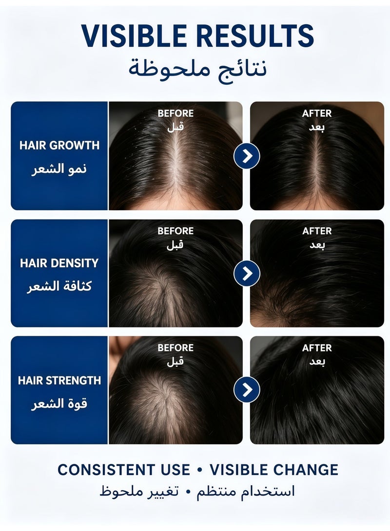 Bodywise 3% Redensyl & Rosemary Hair Growth Serum (Roll On) | Pack of 1 | 2% Anagain | Thicker & Stronger Hair | Prevents Hairfall & Stimulates Hair Follicles | For All Hair Types | 25 ml - Image 2