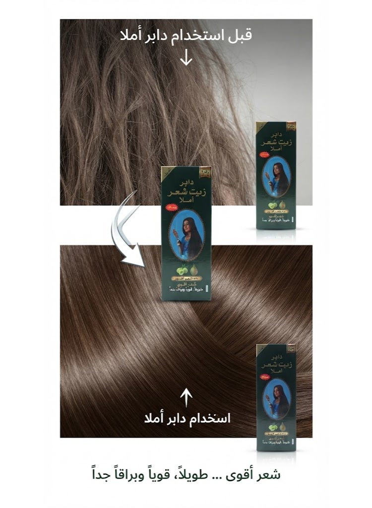 Dabur Amla Hair Oil With Pure Amla Natural Extracts - 270 Ml (Packaging may vary) - Image 2