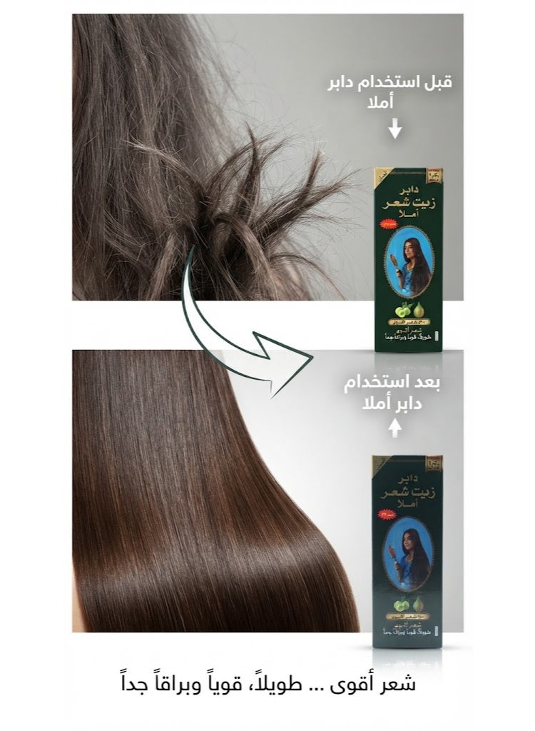 Dabur Amla Hair Oil With Pure Amla Natural Extracts - 270 Ml (Packaging may vary) - Image 3