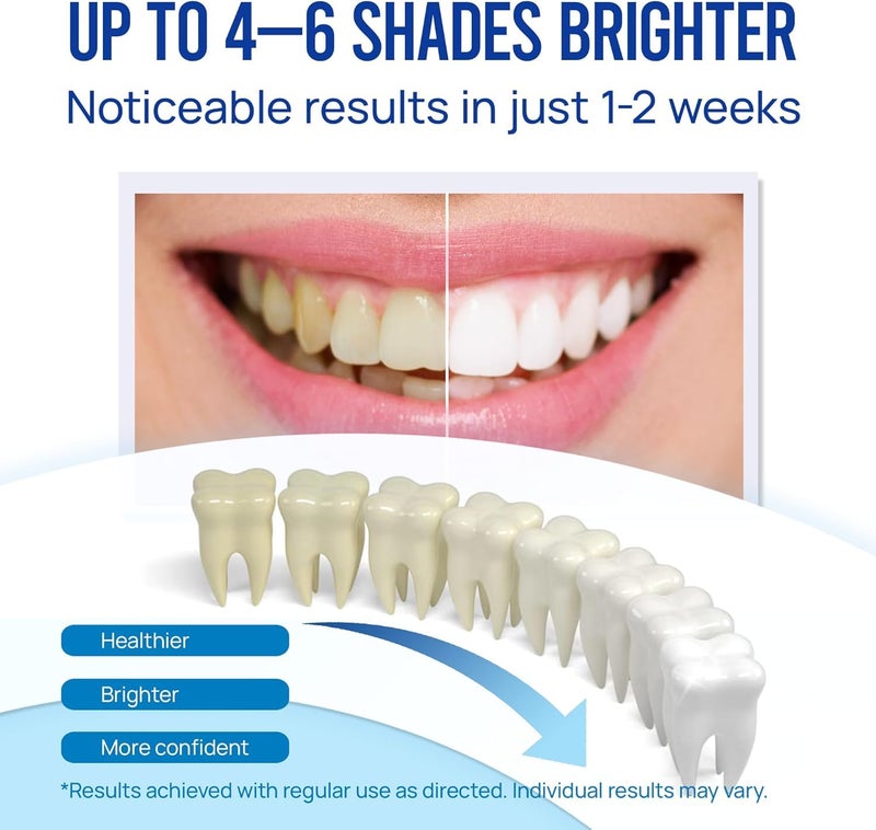 VieBeauti قلم تبييض الأسنان VieBeauti (3 قطع)، أكثر من 30 استخدامًا، فعال، غير مؤلم، لا يسبب الحساسية، مناسب للسفر، سهل الاستخدام، ابتسامة بيضاء جميلة، بنكهة النعناع - Image 2