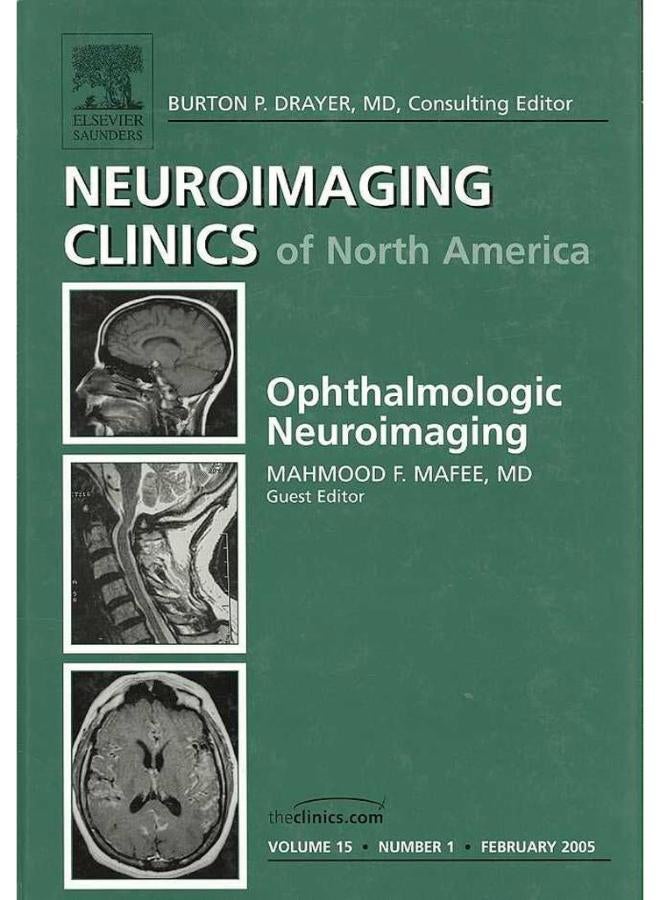 Ophthalmologic Neuroimaging Ophthalmologic Neuroimaging (Neuroimaging Clinics of North America: Volume 15)