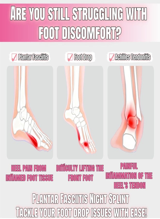 CQSMY Plantar Fasciitis Night Splint for Women & Men, Adjustable 3-Point Support Foot Brace for Foot Drop, Achilles Tendonitis (Pink) - Image 2