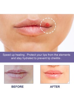 EELHOE 36 Patches Cold Sore Honey Patch Blister Treatment Conceals Protects Soothes & Hides Cold Sores  - Image 5