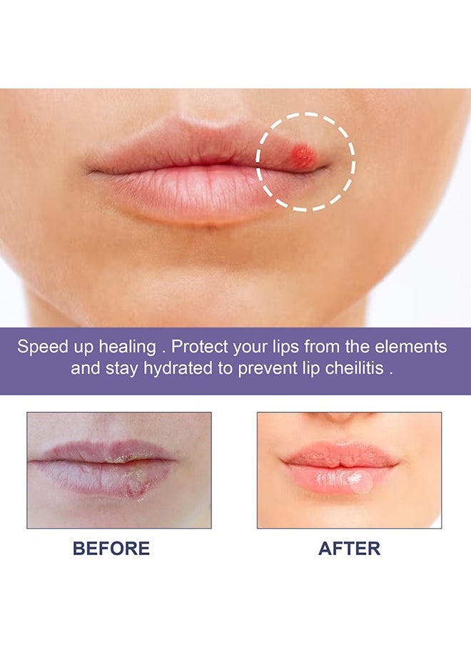 EELHOE 36 Patches Cold Sore Honey Patch Blister Treatment Conceals Protects Soothes & Hides Cold Sores  - Image 5