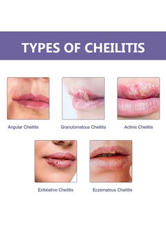 EELHOE 36 Patches Cold Sore Honey Patch Blister Treatment Conceals Protects Soothes & Hides Cold Sores  - Image 4