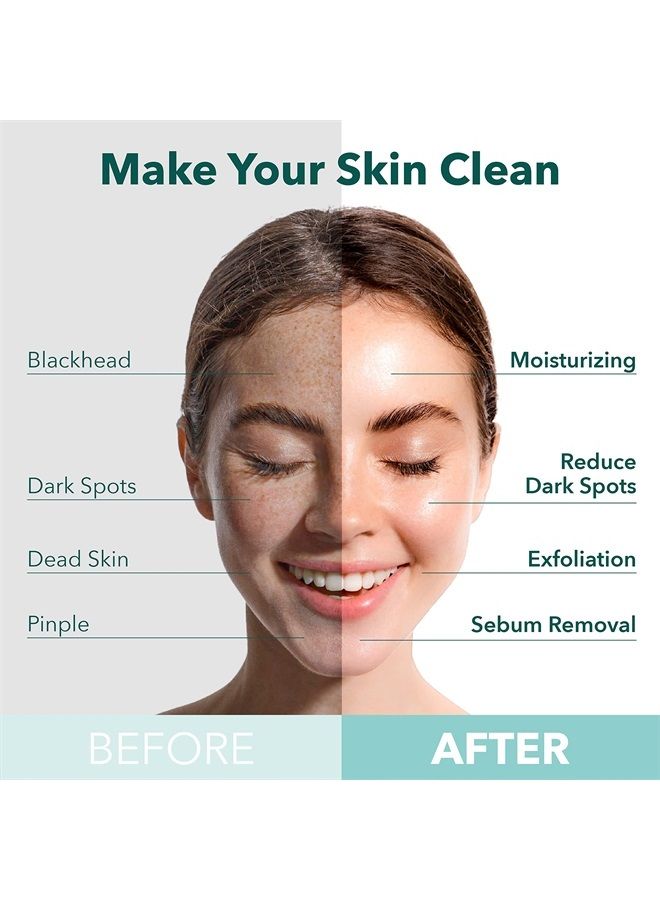 Purederm Turmeric Facial Mask Skin Care (5 Pack) - Bubble Face Sheet Mask for Moisturizing and Hydrating - Rich Collagen and Botanical Extracts Soothe and Illuminate Your Skin - Korean Beauty Skin Mas - Image 2