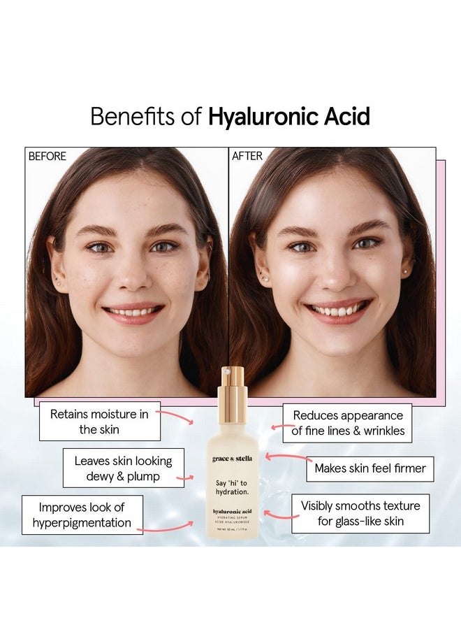 Grace & Stella - Award Winning Hyaluronic Acid Serum (50Ml/1.7 Fl Oz) Hyaluronic Acid Serum For Face - Acido Hialuronico Face Serum For Women - Hydrating Serum Remove Fine Lines, Wrinkles - Anti Aging - Image 1