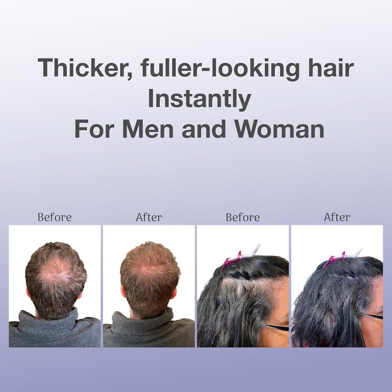 BosleyMD Strength Hair Thickening Fibers - Image 5