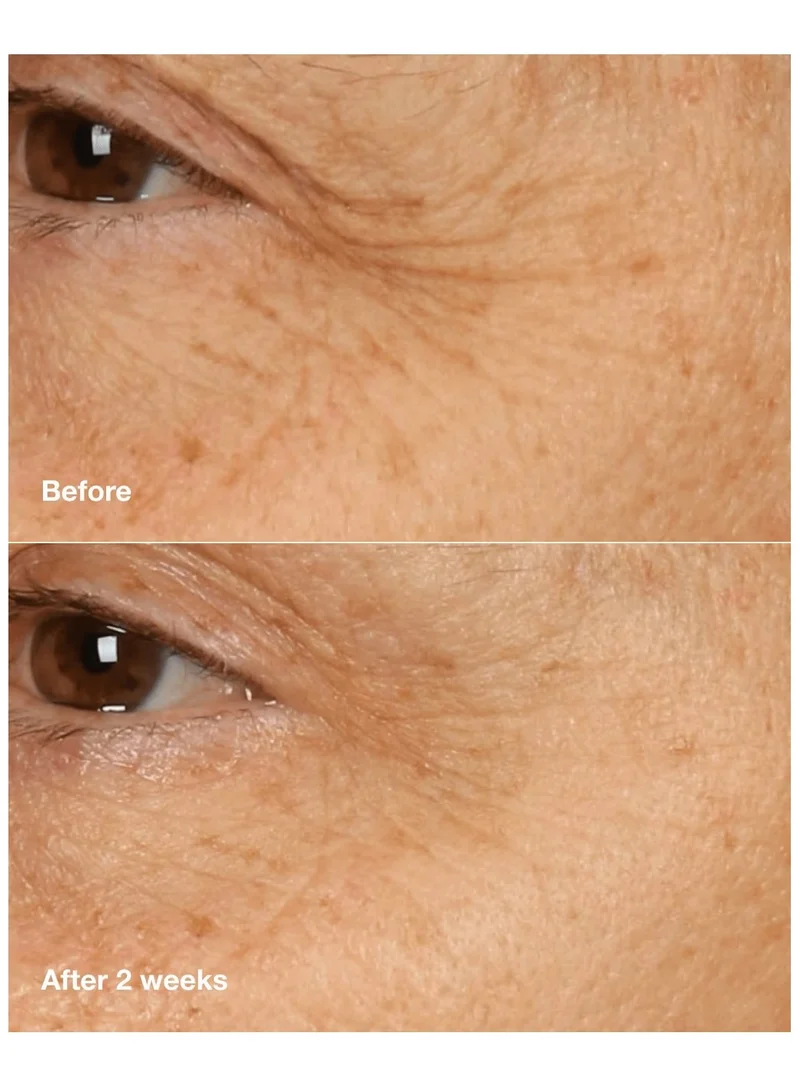 CLINIQUE Smart Clinical Repair Overnight Recovery Cream + Mask